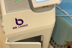 BB laser素顏光國內(nèi)哪個(gè)生產(chǎn)廠家比較好？進(jìn)口素顏光設(shè)備代理商