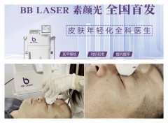 BB.LASER素顏光儀器多少錢一臺(tái)？素顏光儀器價(jià)格_素顏光儀器廠家